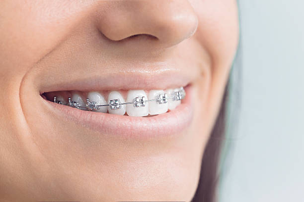 Best Dental Inlays and Onlays  in St John, IN